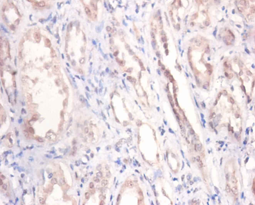 PODXL Polyclonal Antibody