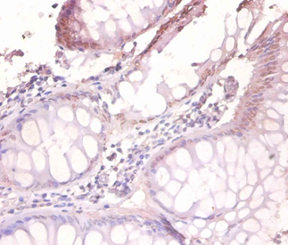 VAMP7 Polyclonal Antibody