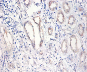 NUP210 Polyclonal Antibody