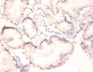 MAPK3 Polyclonal Antibody