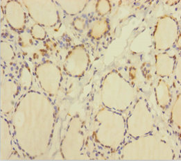TXNL1 Polyclonal Antibody