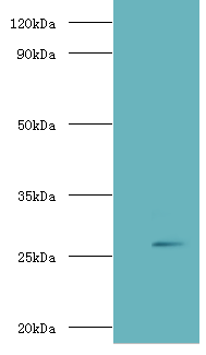 Western blot<br />All lanes: ADIPOQ Polyclonal Antibody at 2ug/ml+recombinant Adiponectin protein 0.1ug<br />Secondary: Goat polyclonal to Rabbit IgG at 1/10000 dilution<br />Predicted band size: 26kDa <br />Observed band size: 26kDa <br />
