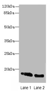 CRABP1 Polyclonal Antibody