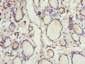 Immunohistochemistry of paraffin-embedded human thyroid tissue at dilution of 1:100