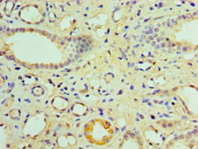 NR1I3 Polyclonal Antibody