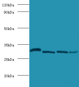 CA2 Polyclonal Antibody