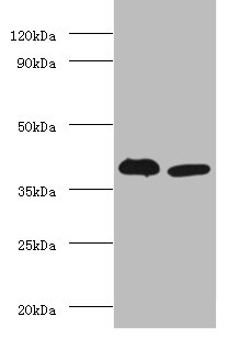 Adh5 Polyclonal Antibody (100 µl)