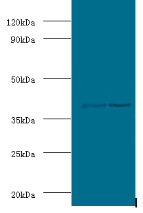 Adh5 Polyclonal Antibody