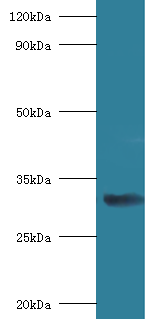 RPSA Polyclonal Antibody