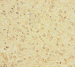DBI Polyclonal Antibody