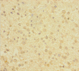 DBI Polyclonal Antibody