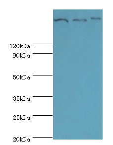 CLTCL1 Polyclonal Antibody