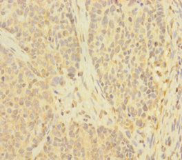 TNFAIP6 Polyclonal Antibody