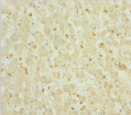 S100A6 Polyclonal Antibody