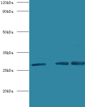 CA1 Polyclonal Antibody
