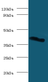 LGALS9 Polyclonal Antibody