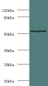 MMP3 Polyclonal Antibody