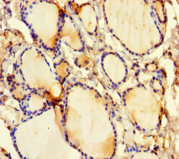 Immunohistochemistry of paraffin-embedded human thyroid tissue using DFNA5 Polyclonal Antibody at dilution of 1:100