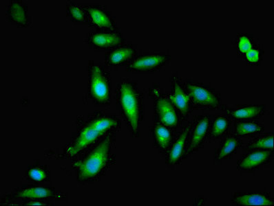 Immunofluorescent analysis of Hela cells using DFNA5 Polyclonal Antibody at a dilution of 1:100 and Alexa Fluor 488-congugated AffiniPure Goat Anti-Rabbit IgG (H+L)