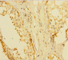 KLK1 Polyclonal Antibody