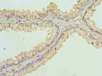KDM5A Polyclonal Antibody