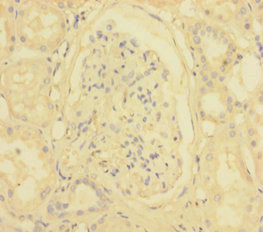 INPP5A Polyclonal Antibody