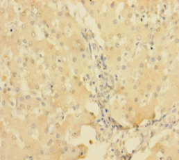 PTPRR Polyclonal Antibody