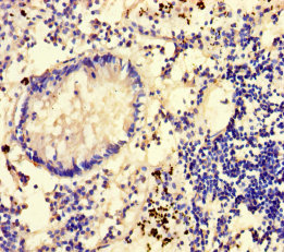 Immunohistochemistry of paraffin-embedded human appendix tissue at dilution of 1:100