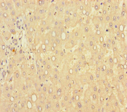 Immunohistochemistry of paraffin-embedded human liver tissue at dilution of 1:100