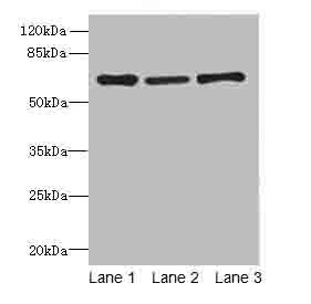 Afp Polyclonal Antibody (100 µl)