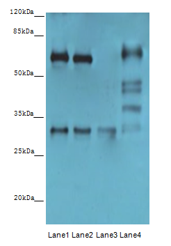 OTX2 Polyclonal Antibody