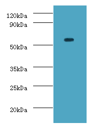 DDX19A Polyclonal Antibody