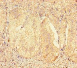 ZNF175 Polyclonal Antibody