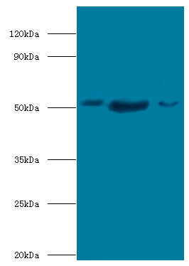 BAG5 Polyclonal Antibody