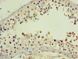 PNMA5 Polyclonal Antibody
