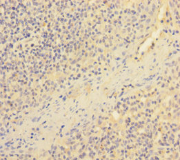 ESAM Polyclonal Antibody