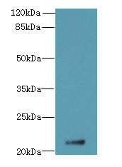 DUSP13 Polyclonal Antibody