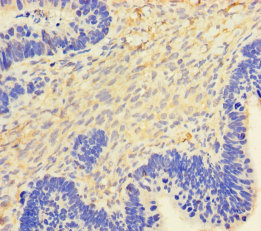 CSF2 Polyclonal Antibody