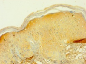 PIP Polyclonal Antibody