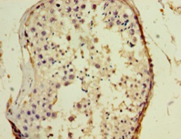 GAGE5 Polyclonal Antibody