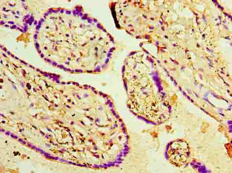 PPARG Polyclonal Antibody