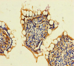 ARHGAP19 Polyclonal Antibody
