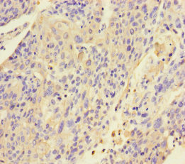 KRT4 Polyclonal Antibody