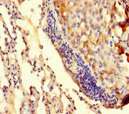 TRMT112 Polyclonal Antibody
