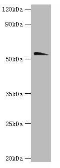 Chrna1 Polyclonal Antibody (100 µl)