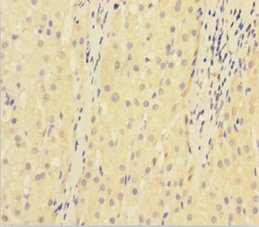 KDR Polyclonal Antibody