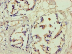 FLG Polyclonal Antibody