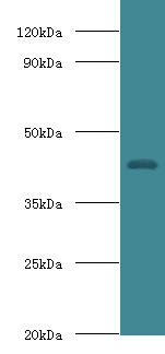 HP Polyclonal Antibody