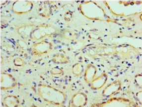 FARSA Polyclonal Antibody