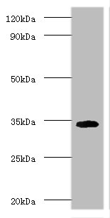 Western blot<br />All lanes:Cd74 Polyclonal Antibody at 2ug/ml+mouse lung tissue<br />Secondary<br />Goat polyclonal to rabbit at 1/10000 dilution<br />Predicted band size: 32, 25kDa<br />Observed band size: 34 kDa<br />